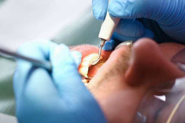 Best Emergency Dentist for Knocked-Out Tooth in Utica, SC